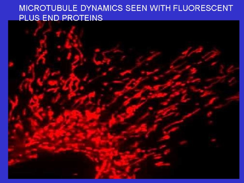 MICROTUBULE DYNAMICS SEEN WITH FLUORESCENT PLUS END PROTEINS